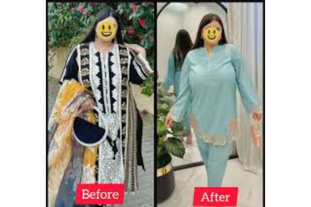 Patient of Dr. Mahboob Ahmad, before and after photo shared by the clinic (6)